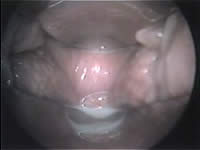 女性がイク瞬間、膣の中の動きはどうなっているのか？