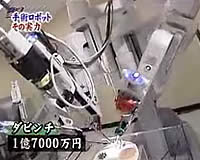 ロボット手術の現場～ロボットで複雑な作業も可能に