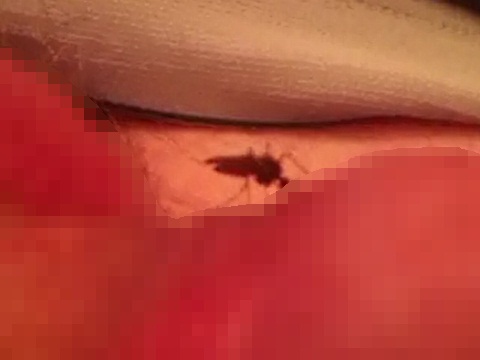 蚊にチンコを吸わせる男性