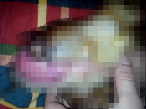 ペニスにかたつむりを乗せる変態男