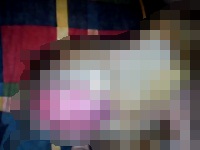 チ●コにカタツムリをくっつけてみた