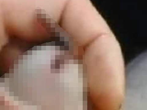 ペニスにミミズを入れようとするマジキチな包茎男